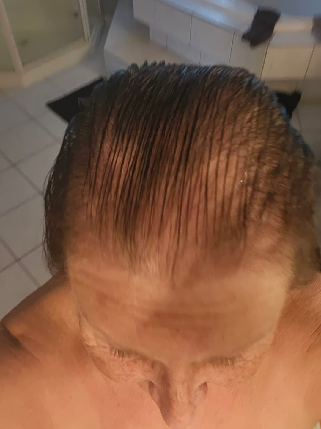 Customer photo review of Scalp Massager — Helps shampoo work at the root