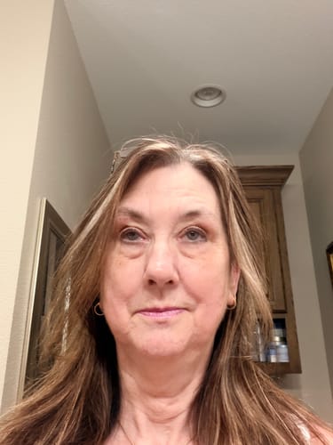 Reviewer's selfie showing her facial skin after using the Seranova Micro Infusion System.