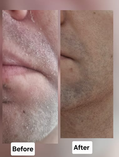 Customer photo review of Seb Natural Soothing Balm