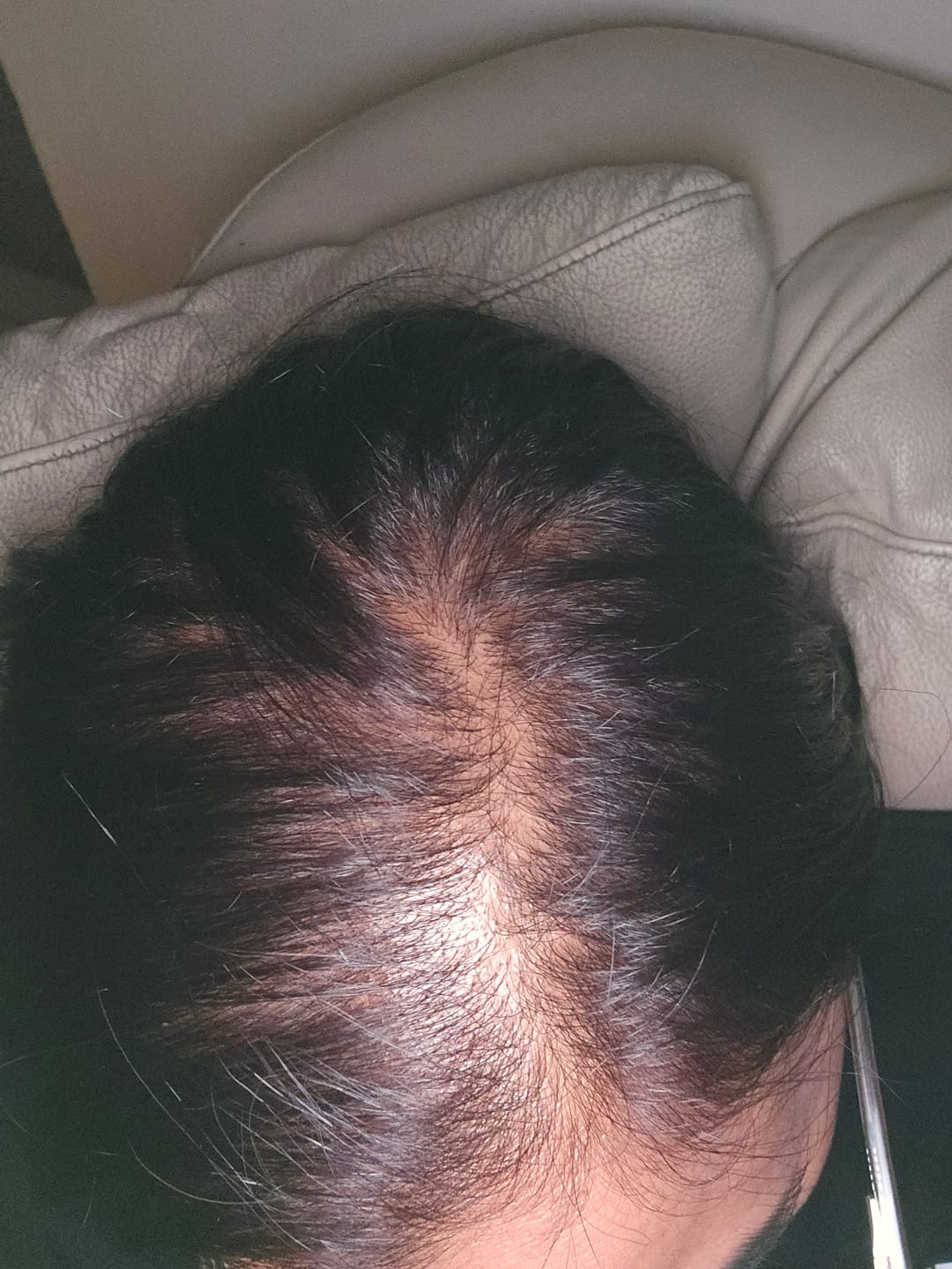 Customer photo review of DEEPLY ROOTED DUO - Advanced Nutraceutical Hair Growth Formula