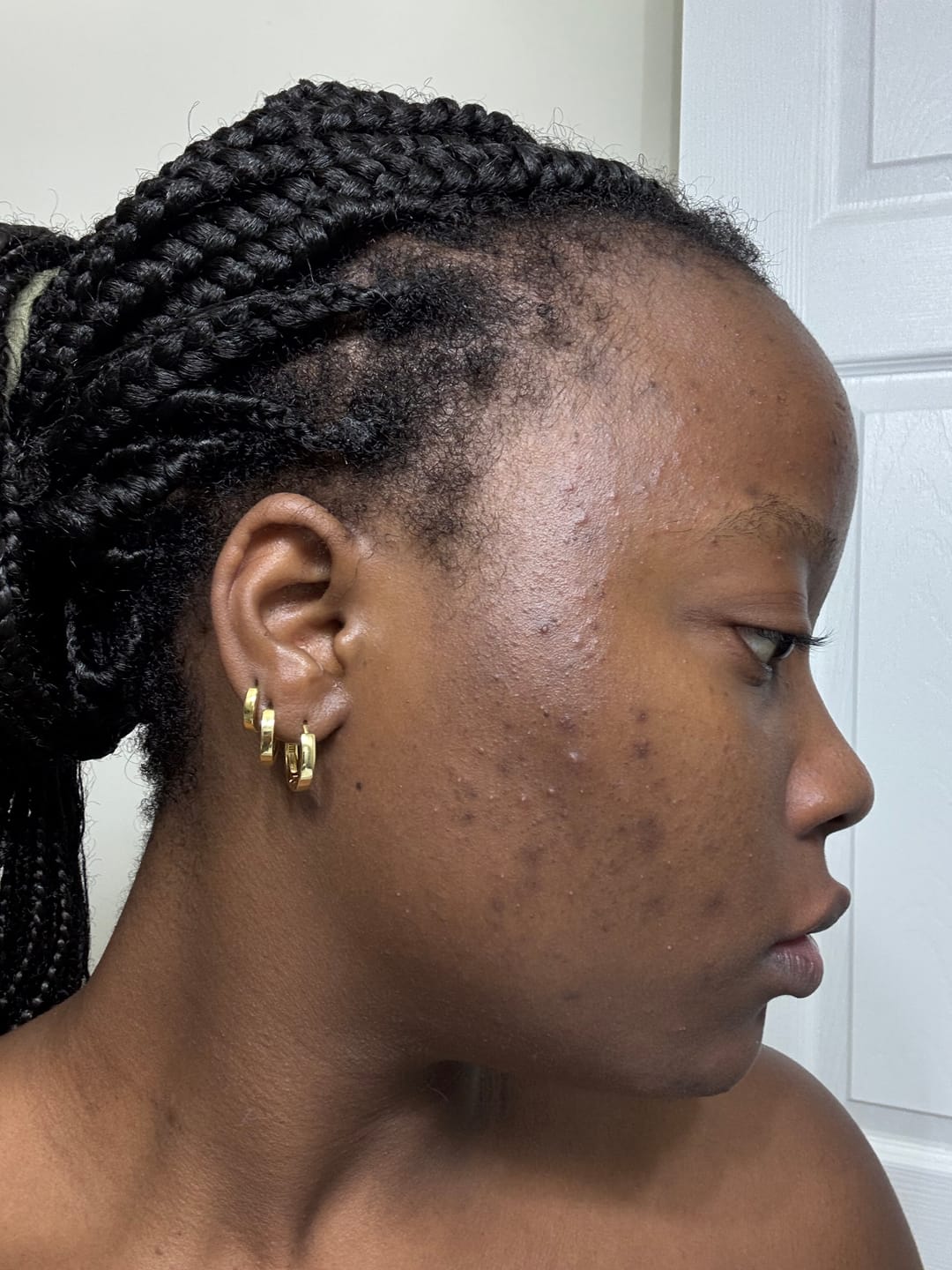 Customer photo review of Dark Spot Serum