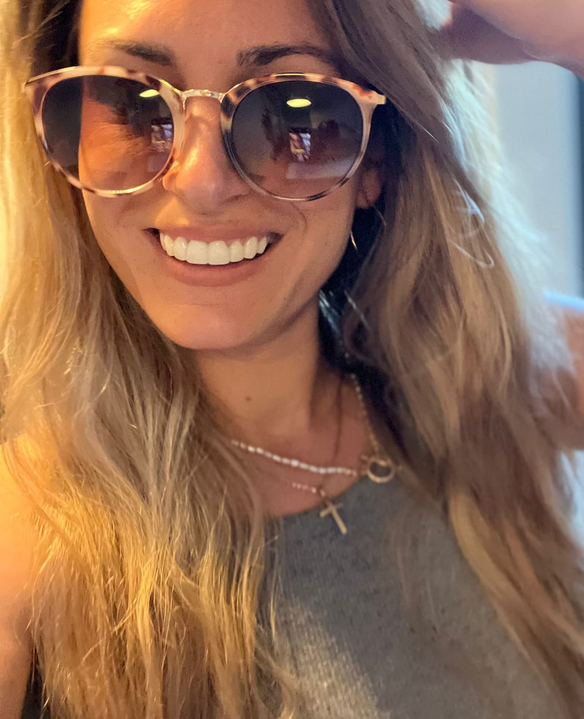 Customer photo review of Faccette-Dentali 3.0