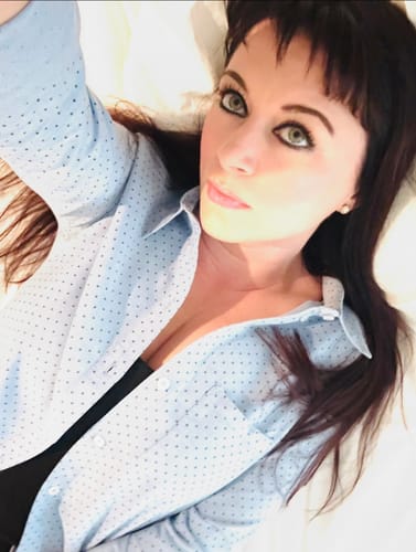 Customer photo review of Transform Wrinkles, Fine Lines, And Tired Creases Naturally