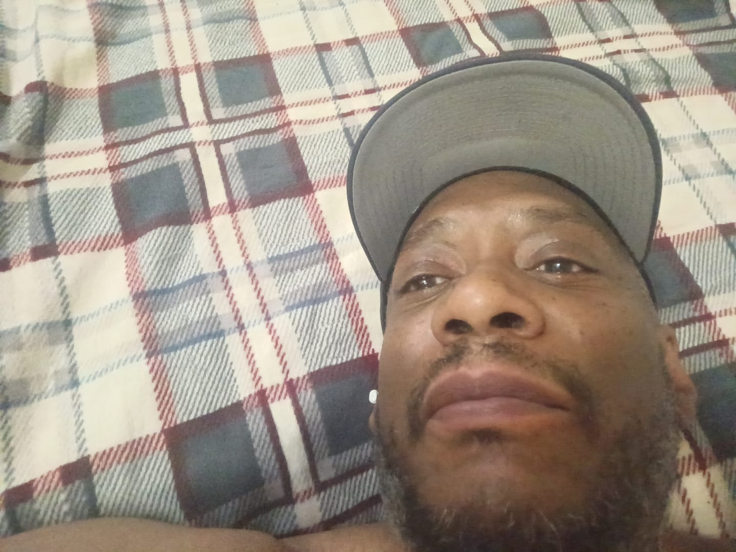 Customer photo review of Lips Lightening Cream For Men and Women (Results in 5 Days or Less)