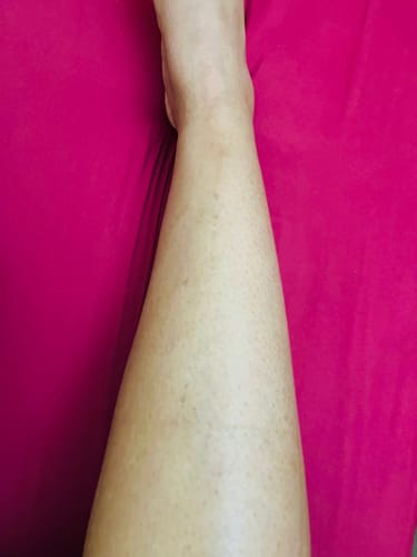 Customer photo review of Glow Getter