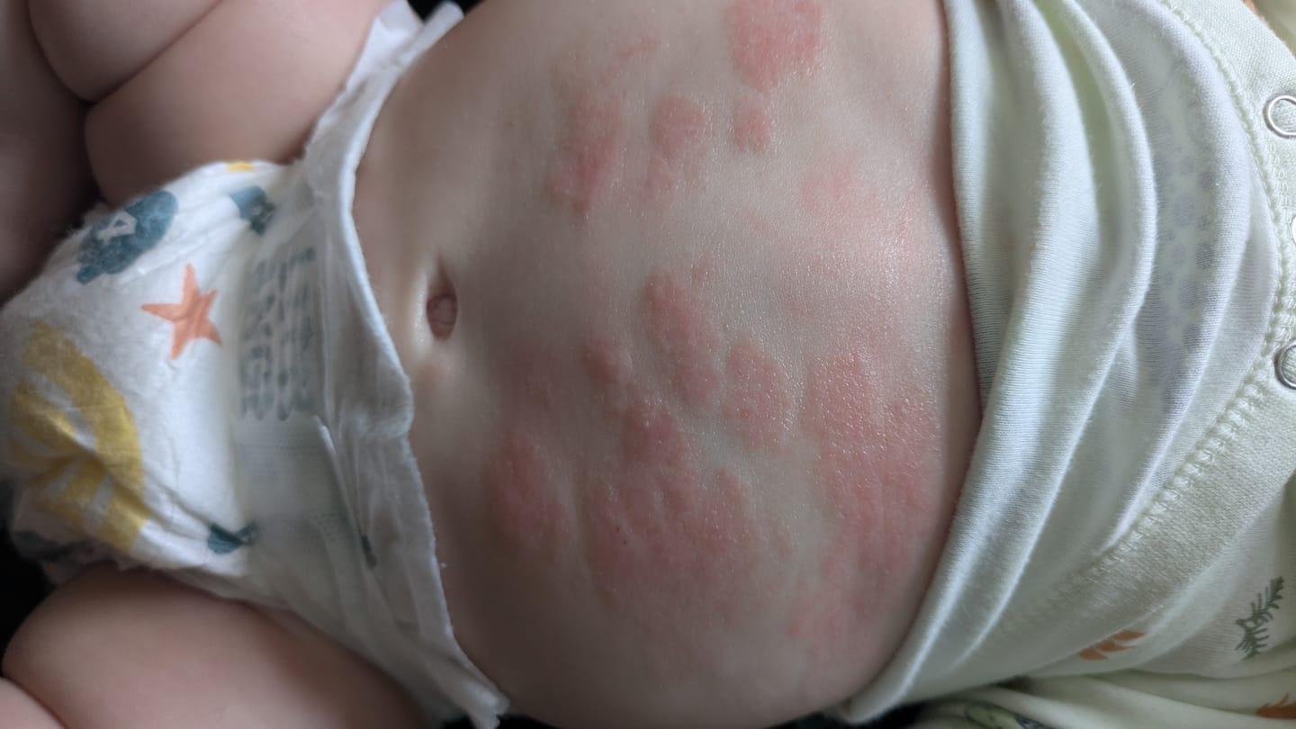 Customer photo review of Bioskin Junior Value Bundle