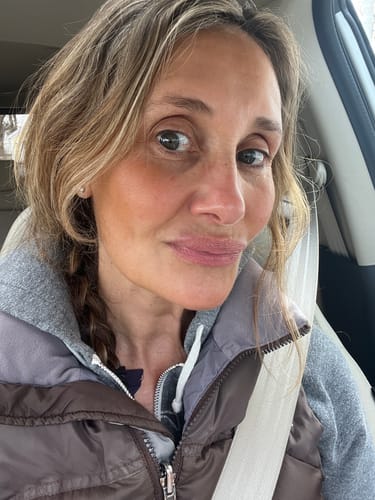 Reviewer's selfie showing her clear, smooth skin after using the Seranova Micro Infusion System.