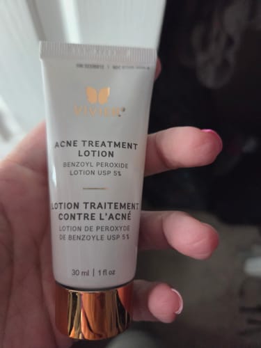 Customer holding the Vivier Acne Treatment Lotion, showing the white tube and gold cap.