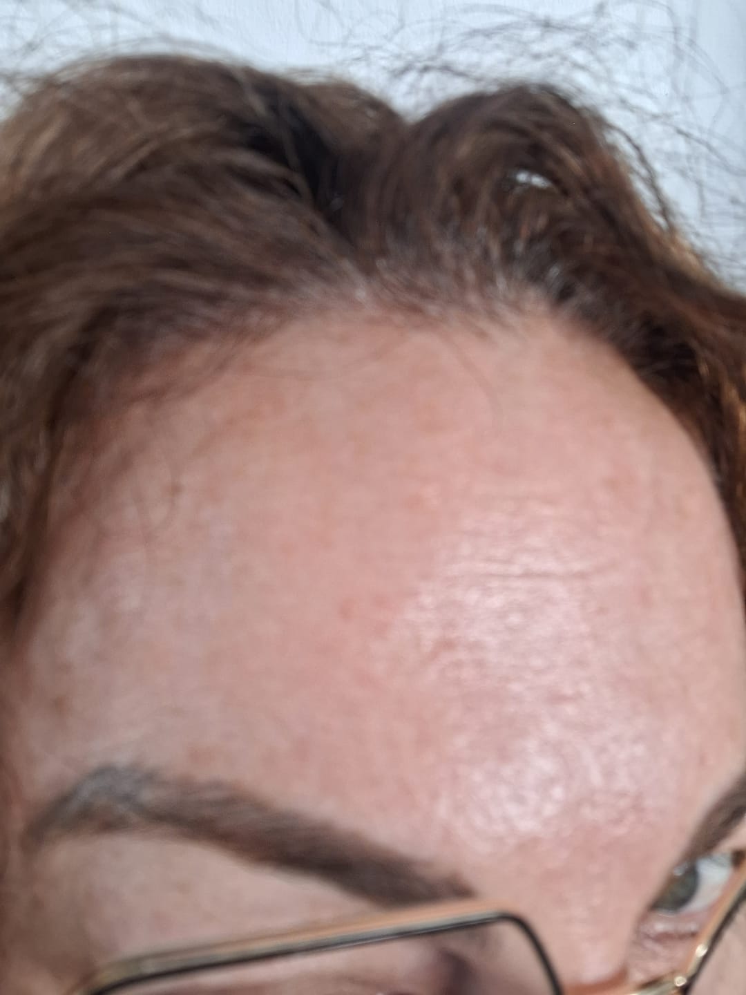 Customer photo review of Sérum de Exosomas Ultra Rejuvenecedor con Bioexosomas de Bakuchiol