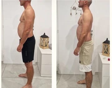 Customer photo review of Parches Detox Lumilegs™ - Recuperá un aspecto firme y masculino.