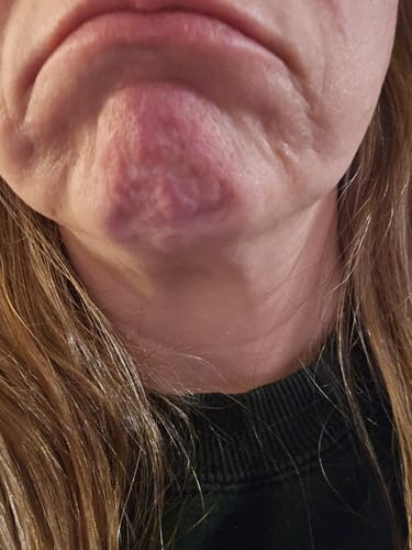 Customer photo review of HER+ Balm Monthly Refill