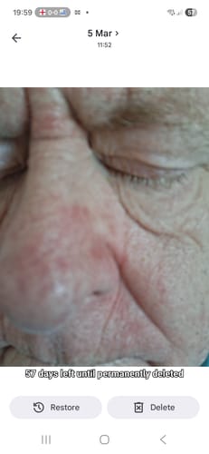Customer photo review of Seb Natural Calming Serum
