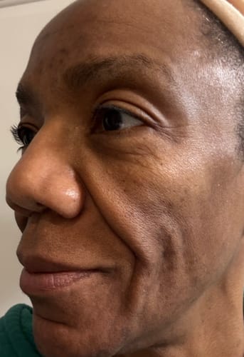 Close-up of a reviewer's face from the side, showing her skin after using the Turmeric Fade & Glow Bar.