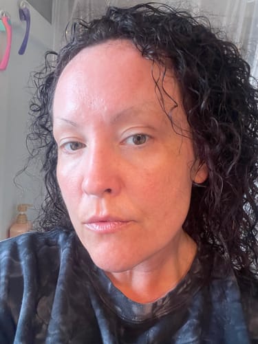 Customer photo review of Transform Wrinkles, Fine Lines, And Tired Creases Naturally