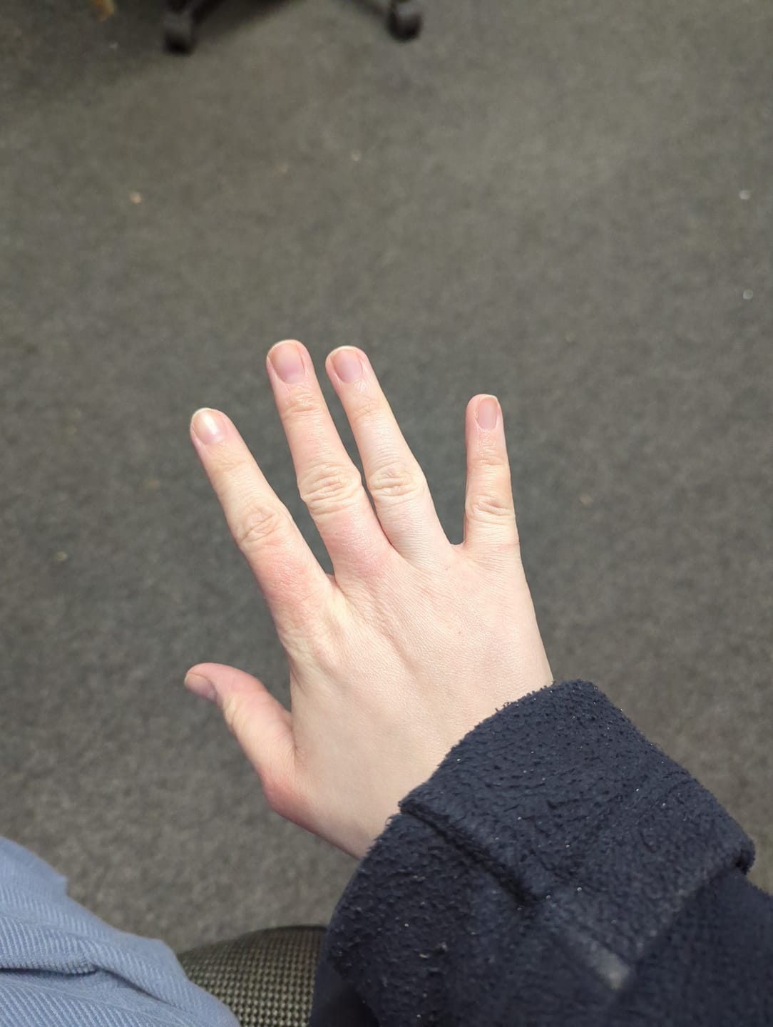 Customer photo review of Prebiotic Hand & Body Repair Cream