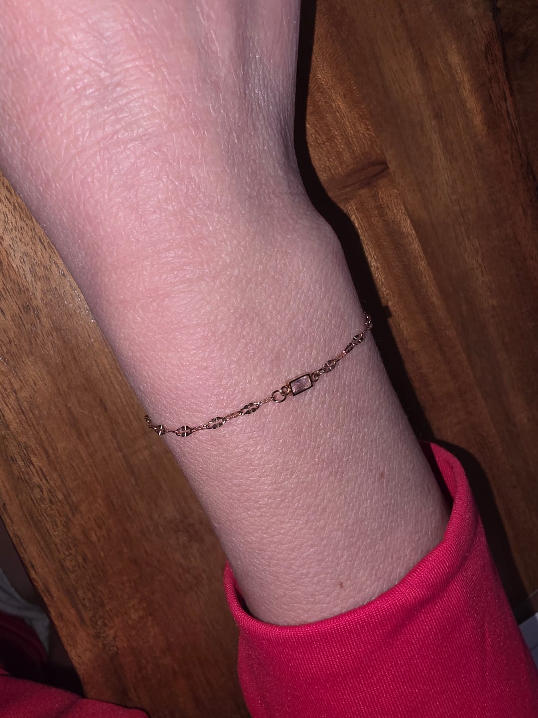 Customer photo review of Permanent Armband - dein everbond in Berlin