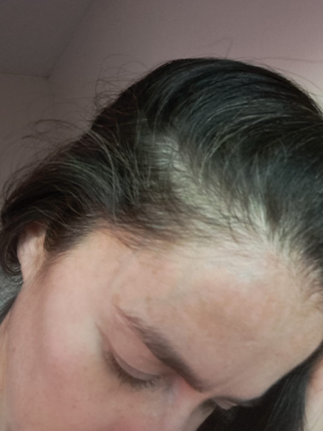 Customer photo review of DUO ANTIcaída CRECIMIENTO INTENSIVO Bomba + Tónico