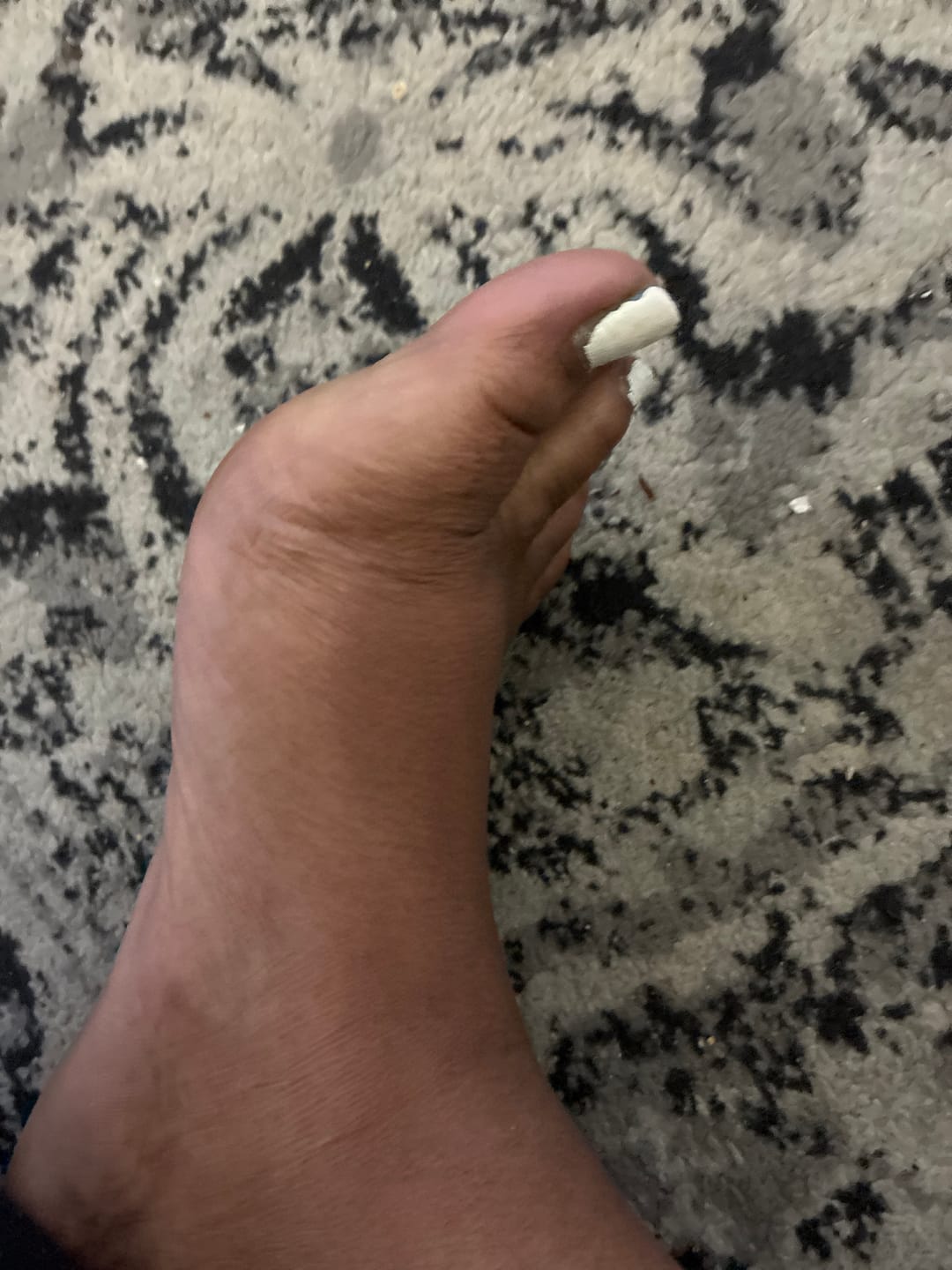 Customer photo review of Her Fantasy Bundle - Vaginal Care Products