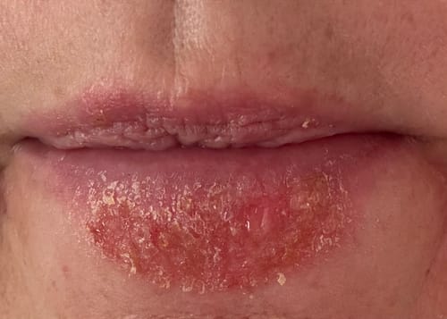 Customer photo review of Face Butter (45ml)