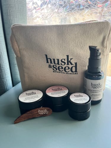Customer photo review of Hydration Boost Moisturising Balm