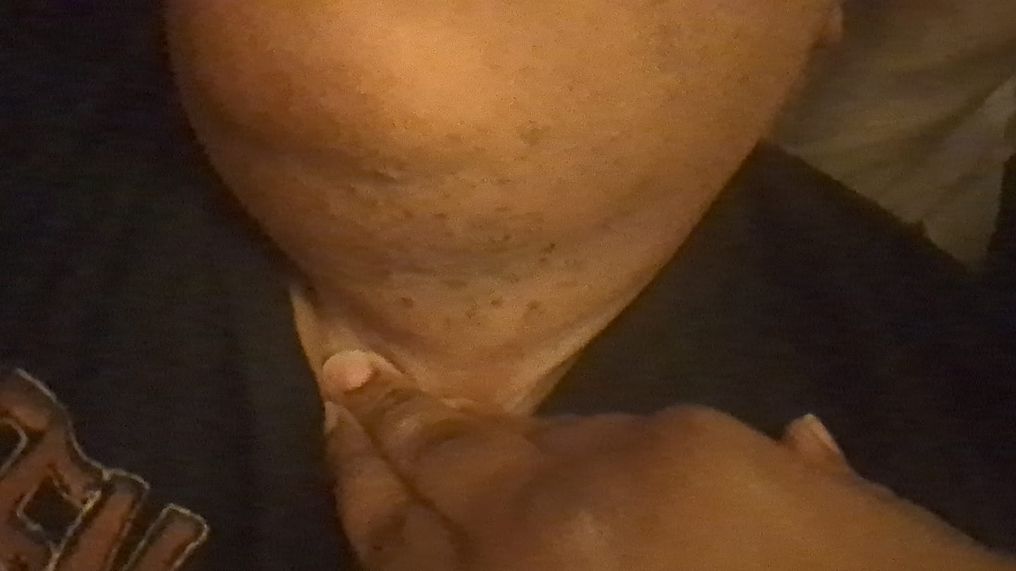 Customer photo review of JellyCare™ Pre & Post Wax Routine
