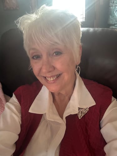 Reviewer's selfie showing facial skin results after using the Seranova Micro Infusion System.