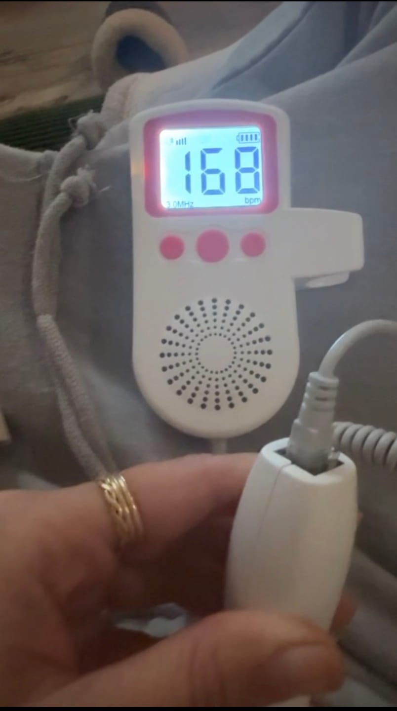 Customer photo review of Masovi At Home Baby Doppler