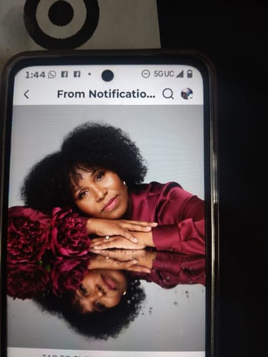 Customer photo review of Transform Wrinkles, Fine Lines, And Tired Creases Naturally