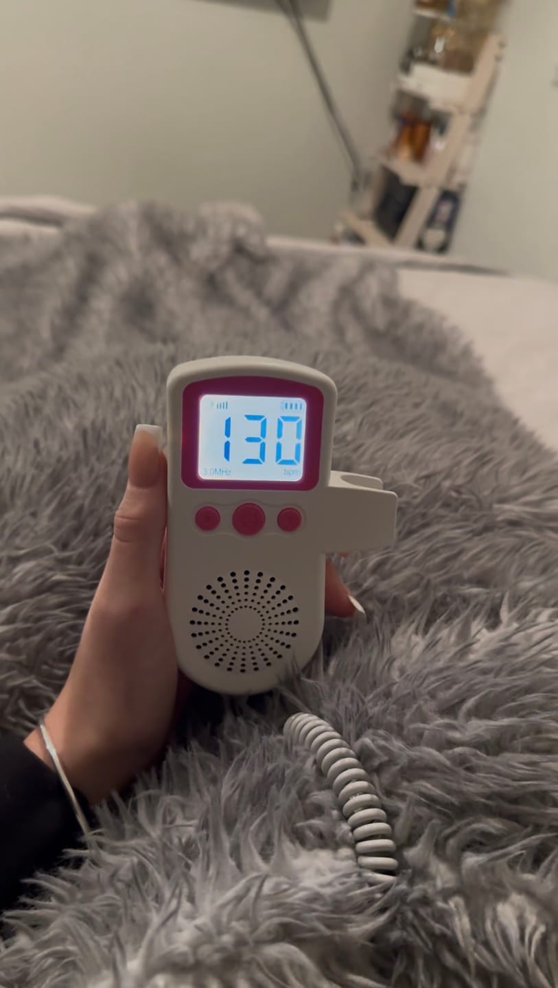 Customer photo review of Masovi At Home Baby Doppler