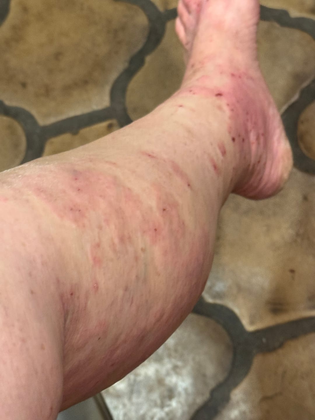 Customer photo review of Total Tissue Cell Salt Mineral Combination BIO28 - Helps Your Body Absorb and Use Nutrients, Increases Energy Levels, Helps Improve Sleep Patterns, Overall Health and Vitality | Pellets, Big Jar