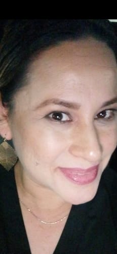 Customer photo review of Transform Wrinkles, Fine Lines, And Tired Creases Naturally