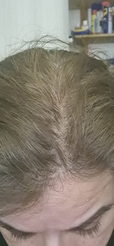 Customer photo review of VITAFOAM ™ Hair Growth Formula