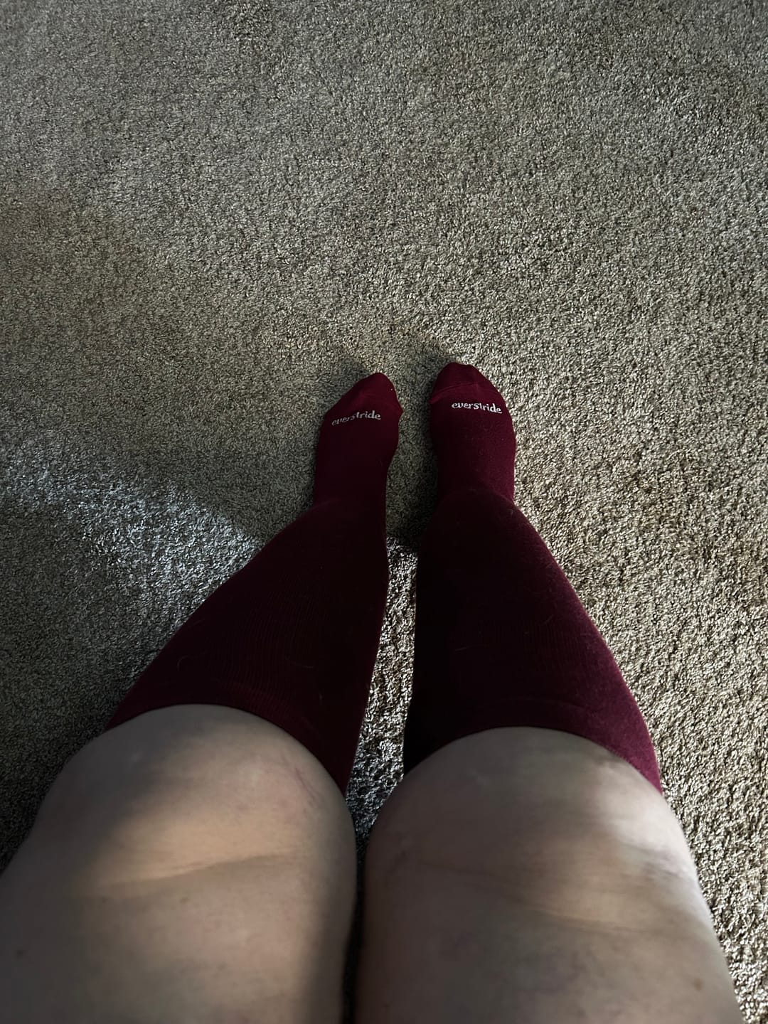 Customer photo review of Everstride™ Bamboo Compression Socks