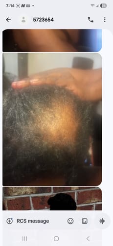 Customer photo review of Miracle Hair Growth Oil