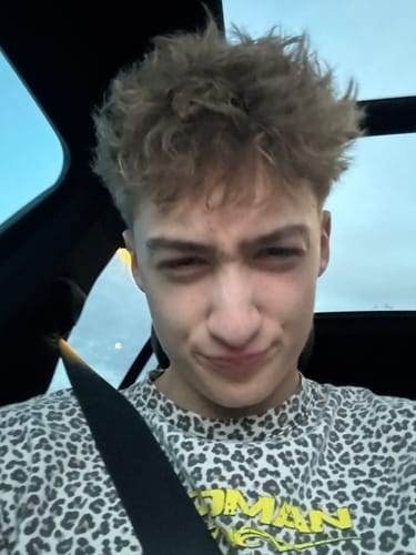 Reviewer showing their clear-looking skin after using the Full Skincare Kit.