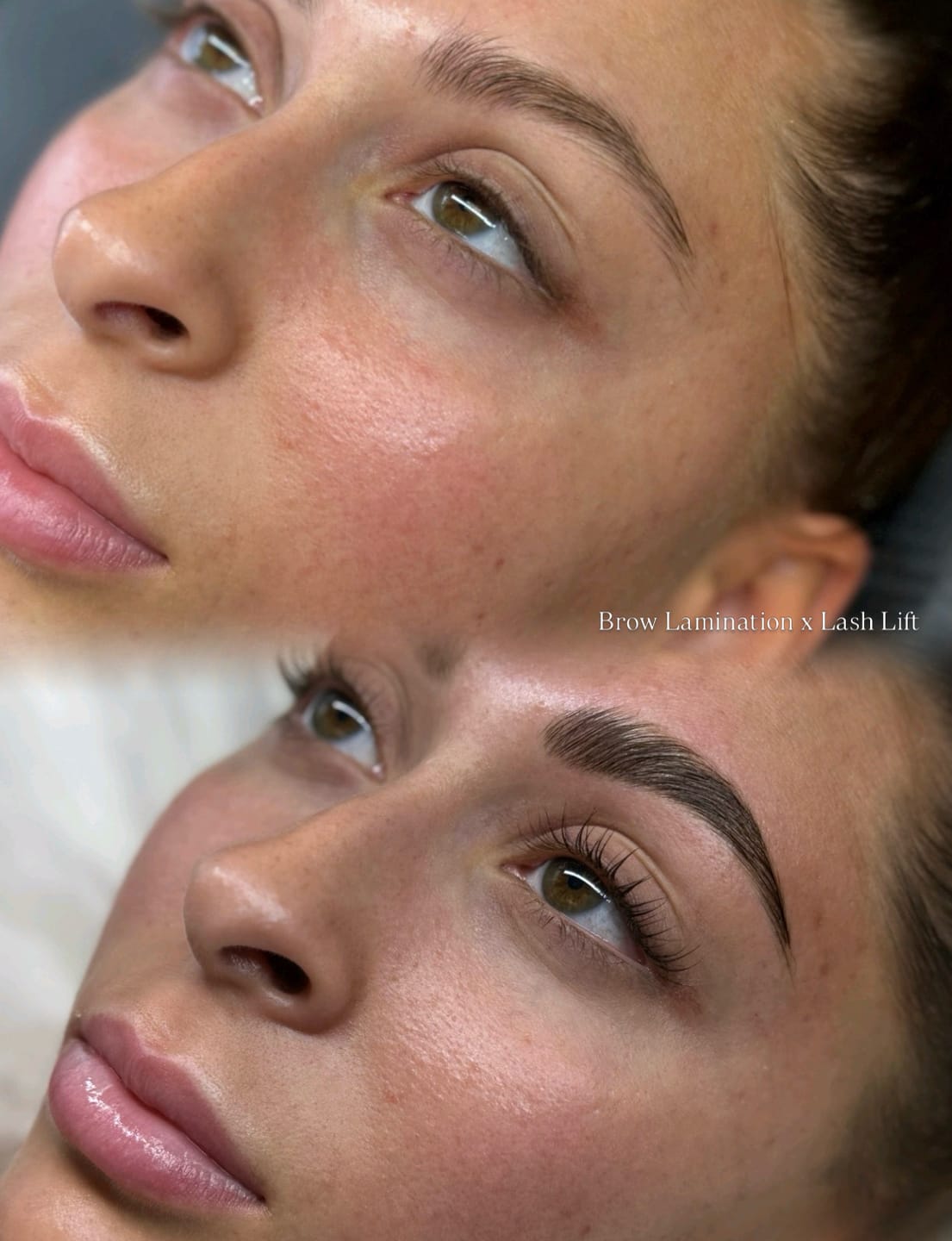 Customer photo review of TGA vs Cysteamine
