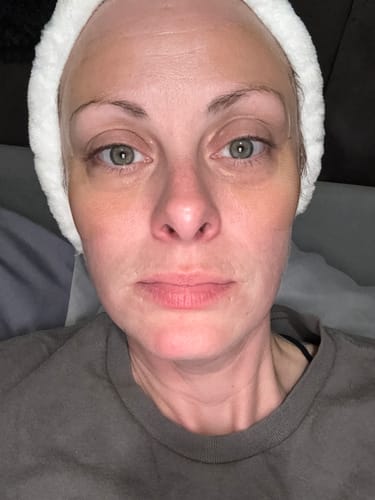 Customer photo review of COMPLETE FACE RENEWAL KIT