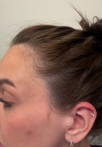 Customer photo review of TR Hair Oil Essentials Bundle ($66 value)