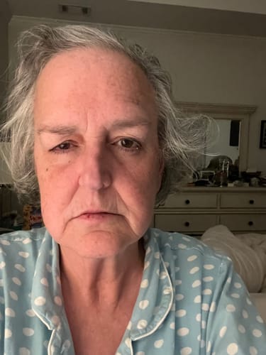 Reviewer's face showing their skin before using Neptune Tallow & Honey Balm, with chapped lips.