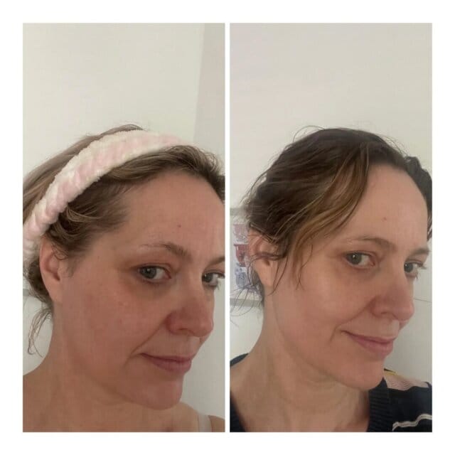 Customer photo review of Интензивна Пептидна Ампула За Бръчки