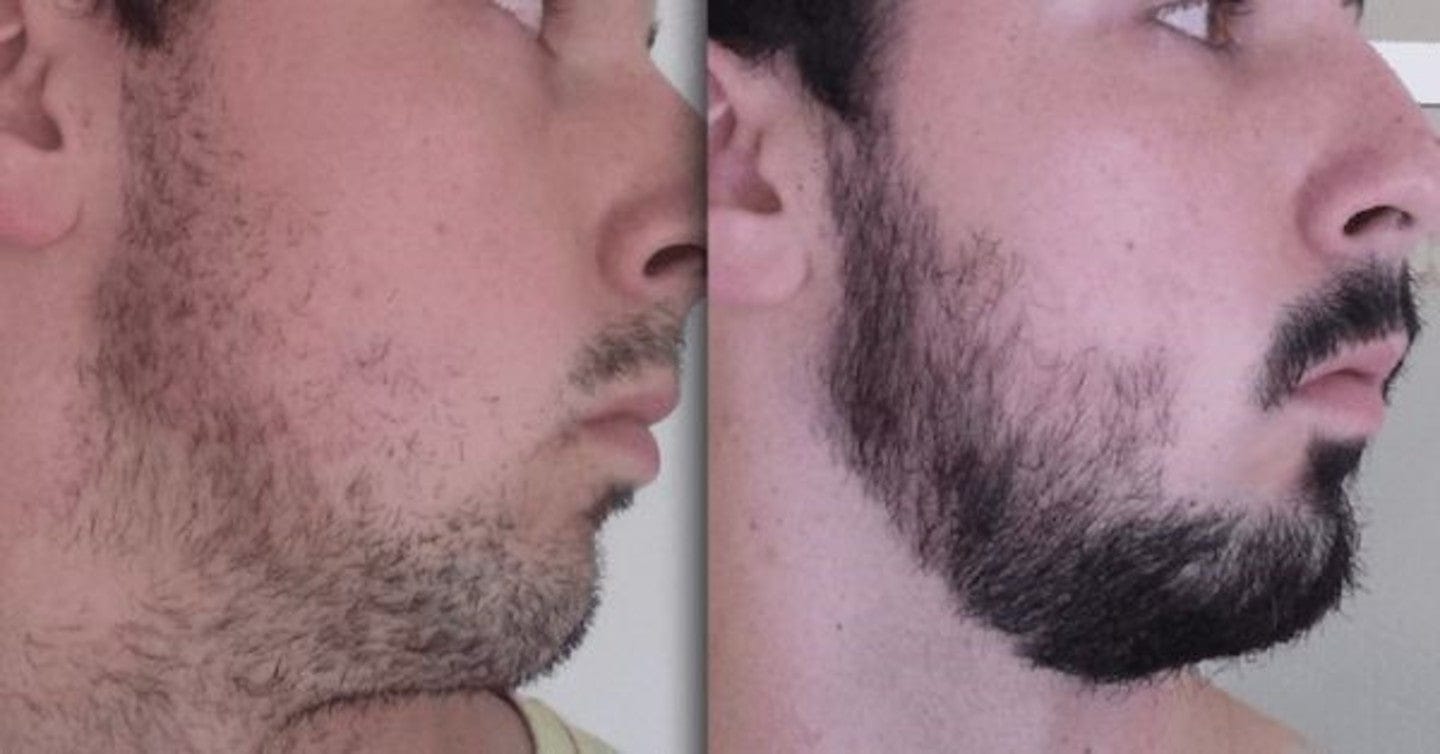 Customer photo review of 1 Bálsamo Mélamus