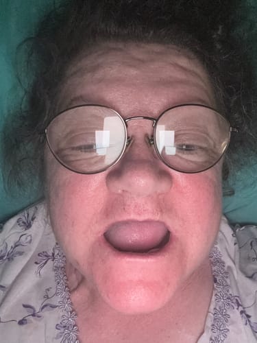 Customer photo review of 🦷  Fit Full Functional DenturesMake you more confident-Made in the USA & FDA-Certified