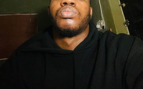 Customer photo review of BEARD GROWTH FOAM - NOVIFUL