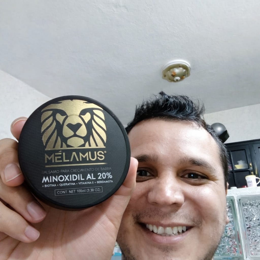 Customer photo review of 2 Bálsamos Mélamus + 1 Dermaroller Gratis
