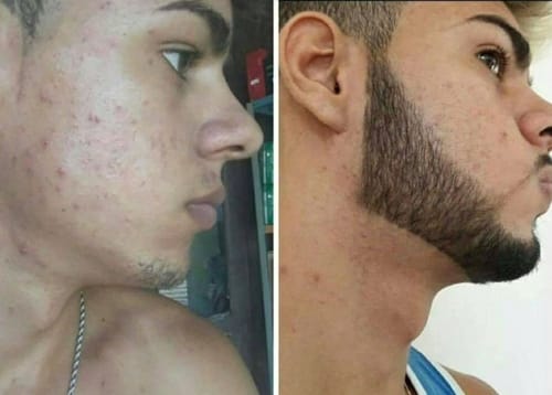 Foto de barba compartida por un usuario