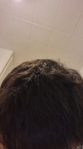 Reviewer's close-up of their scalp and dark hair after using the Shower Duo shampoo and conditioner.