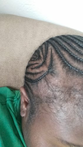 Customer photo review of Minoxidil 5% FOAM, 3x60ml pack