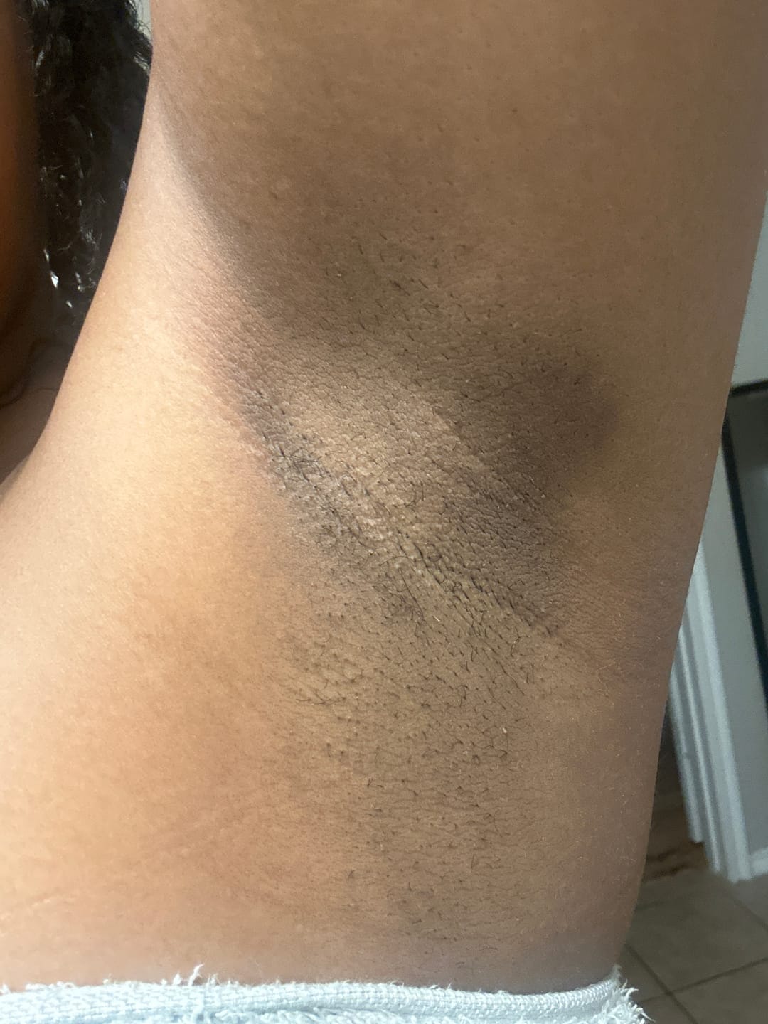 Customer photo review of Her Fantasy Bundle - Vaginal Care Products