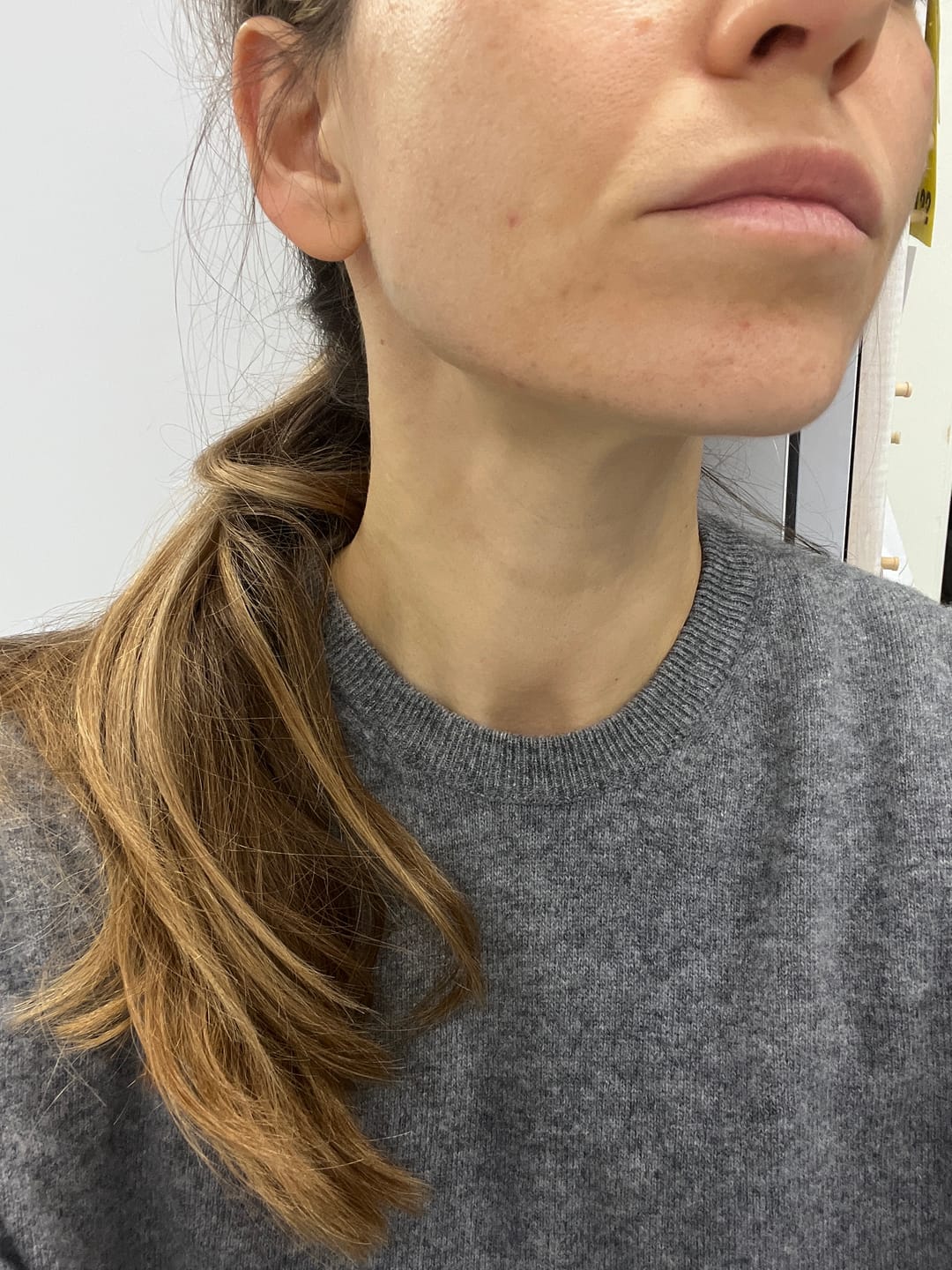 Customer photo review of A CONTROL + CORTIZEN - Equilibrio hormonal desde el cerebro, los ovarios, la piel y el metabolismo.
