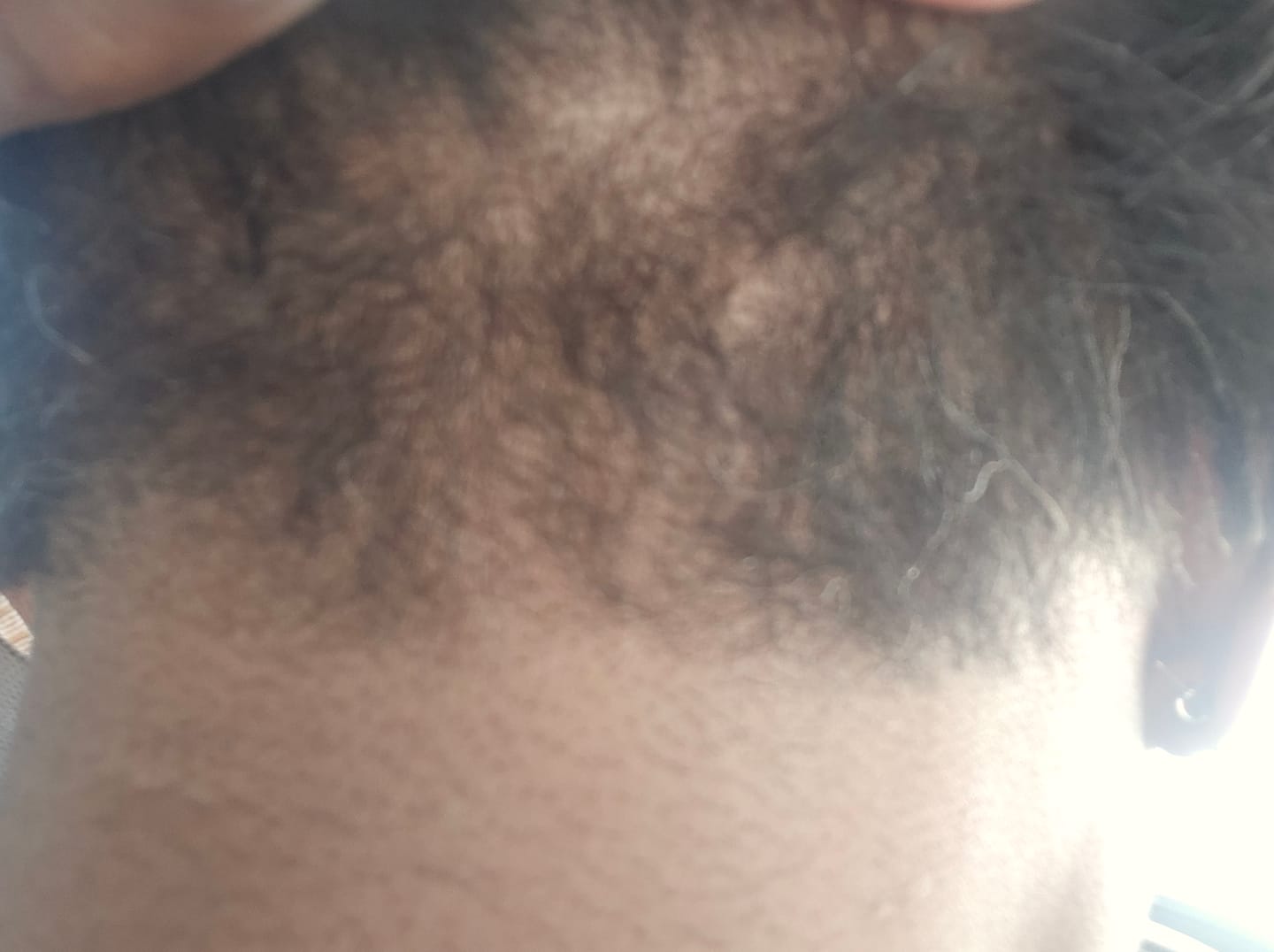 Customer photo review of Herbal Hair Growth Oil
